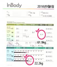 치료 전