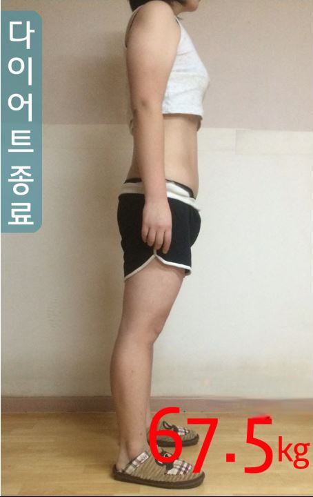 안양점 치료 후