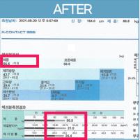 부산점 치료 후